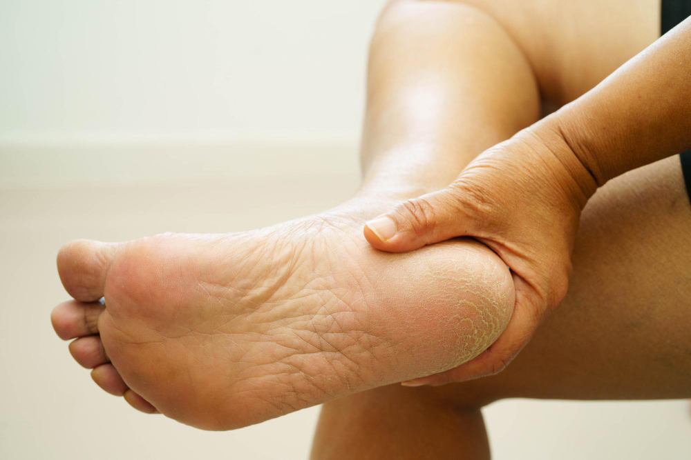 Diabetic Foot Care Highlands Ranch, CO